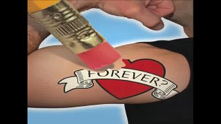 Tattoo Removal Reviews - Cheap, Amazing Results!