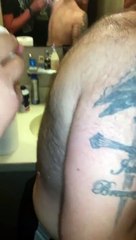 Il éclate un énorme bouton dans le dos