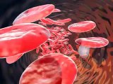 Kan kan sayısı damar  tıkanıklıgı damar ameleyatı Dekompresyon Hastalıgı Vurgun Blood