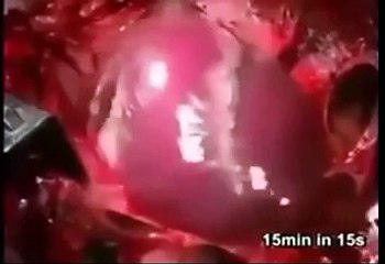 Ruh bedenden çıkarken insanın kalbi böyle duruyor!