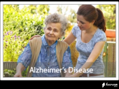Alzheimer's Disease Treatment with Lake Charles Clinical Trials