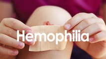 Hemophilia: Symptoms, Diagnosis and Treatment || Health Tips