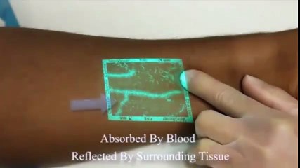 Viewing Vein Flows - Technology Innovation