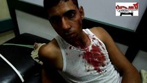 عااااااجل مجند شرطة مصاب فى اشتباكات دمنهور الاخوان ماسكين سلاح وطوب وكل حاجه
