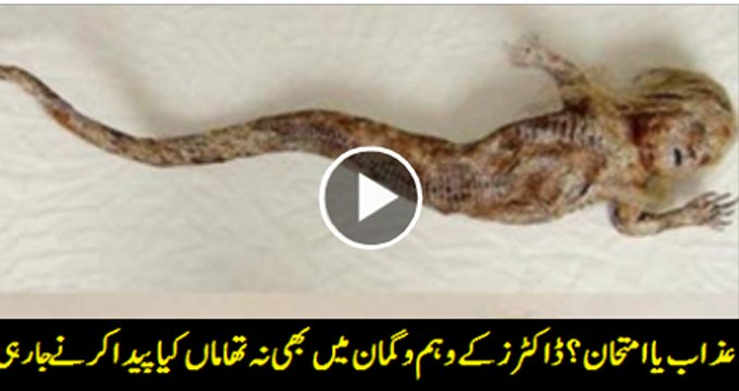 Trapped Snake Thanks It’s Rescuers With A Surprise.
