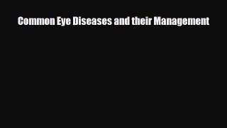 [PDF] Common Eye Diseases and their Management Read Full Ebook
