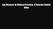 [PDF] Eye Disease in Clinical Practice: A Concise Colour Atlas Download Full Ebook