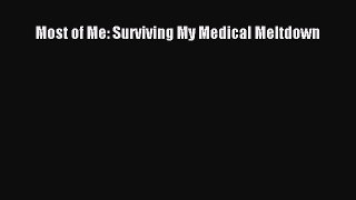 Read Most of Me: Surviving My Medical Meltdown Ebook Free