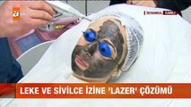 Leke ve sivilce izine lazer çözümü - atv Gün Ortası Bülteni