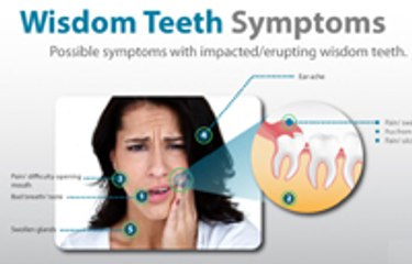 Dental Health | Wisdom Tooth Age | Wisdom Tooth Pain | Wisdom Tooth Coming Out & Handling