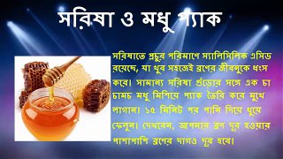 Beauty Tips to remove Acne in Bangla