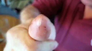 Neil Cuts His Thumb