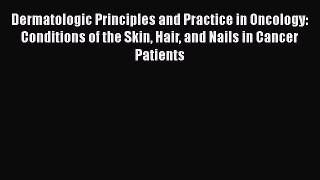 Read Dermatologic Principles and Practice in Oncology: Conditions of the Skin Hair and Nails
