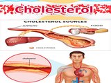 What is cholesterol_ (LDL, HDL) How to prevent and treat bad cholesterol