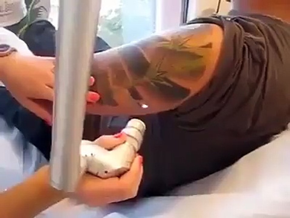 Tatoo removal machine