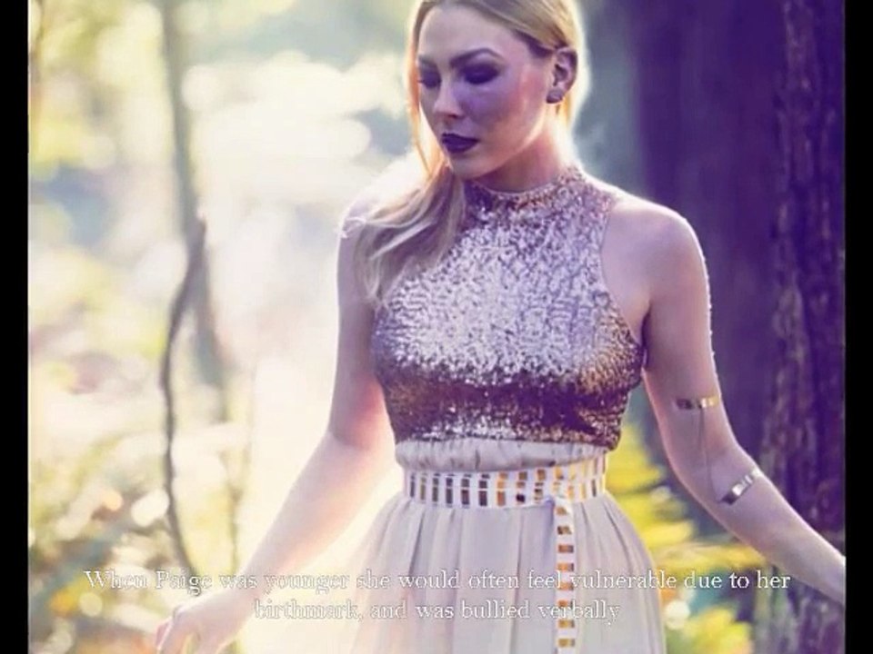 Ce bébé est né avec cette tache au visage. 23 ans plus tard, voici ce qu'elle est devenue!