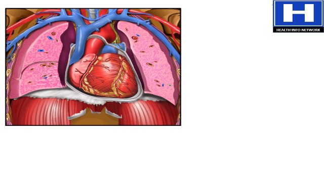 How atherosclerosis develops - How atherosclerosis damages heart - Atherosclerosis causes and complications