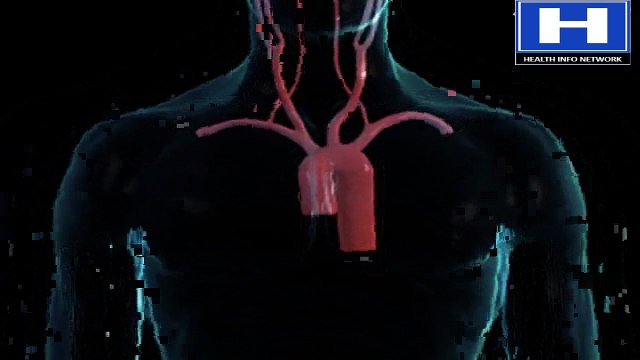 Embolism vs Thrombus symptoms, causes, pathophysiology and treatment