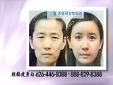 Korean Cosmetic Surgery