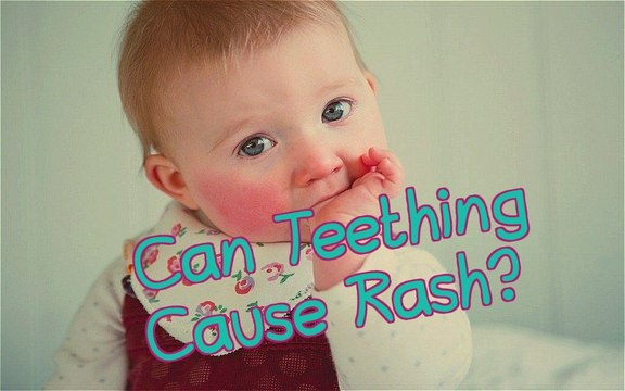 Teething Rash in Babies - Teething Rash Remedies