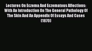 [PDF] Lectures On Eczema And Eczematous Affections: With An Introduction On The General Pathology