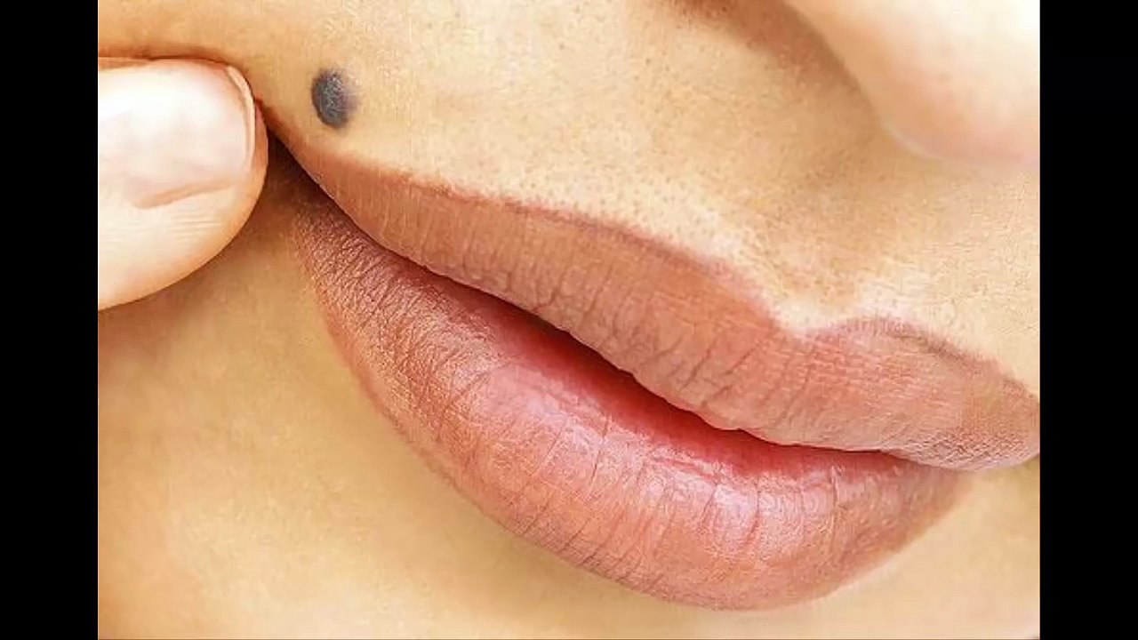 Si usted tiene un lunar en uno de esto 7 lugares en su cuerpo esto es lo que significa. Usted se sor