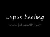 Spinal pain and limping healed - John Mellor Healing in Jesus' Name