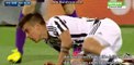 Mario Mandzukic Gets Injured - Fiorentina vs Juventus - Serie A - 24.04.2016