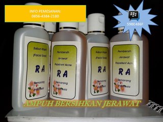 0856-4384-2180 obat jerawat muka