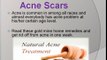 How to get rid of acne scars on face, nose, back, arms, legs fast overnight