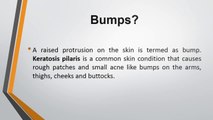 Neck Bumps Acne Keloidalis Nuchae Razor Bumps Back Of Head