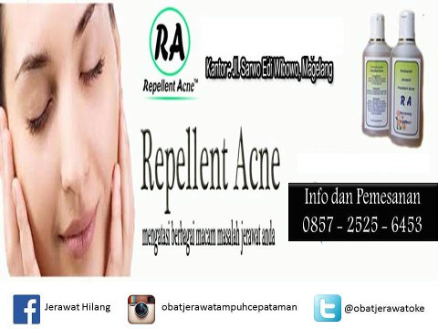 SMS 0857-2525-6453 // Obat ampuh jerawat dan bekasnya