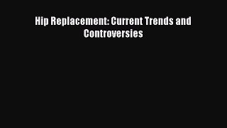 Read Hip Replacement: Current Trends and Controversies Ebook Free