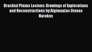 Read Brachial Plexus Lesions: Drawings of Explorations and Reconstructions by Algimantas Otonas