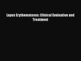 [Read Book] Lupus Erythematosus: Clinical Evaluation and Treatment  EBook