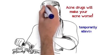 Acne No More - Comprehensive Acne no more solution