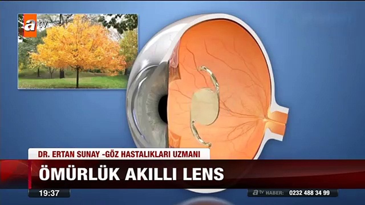 Op.Dr. Ertan Sunay ATV Ana Haber Akıllı Lens