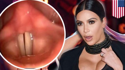 How vocal fry works and why doctors think it's bad for you