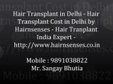 Meet the Hair Transplant Experts in Delhi, India - Hair & Senses