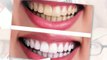 Best cosmetic dentist with teeth whitening cosmetic dentistry in Paradise Valley AZ