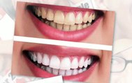 Best cosmetic dentist with teeth whitening cosmetic dentistry in Litchfield Park AZ