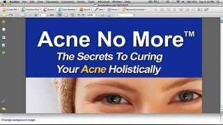 Acne No More Book Review - Is It Worth Buying