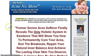 Acne No More By Mike Walden Review - Scam or Legit