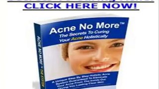 Acne Treatment Suffer Acne No More With Natural Treatments For Acne