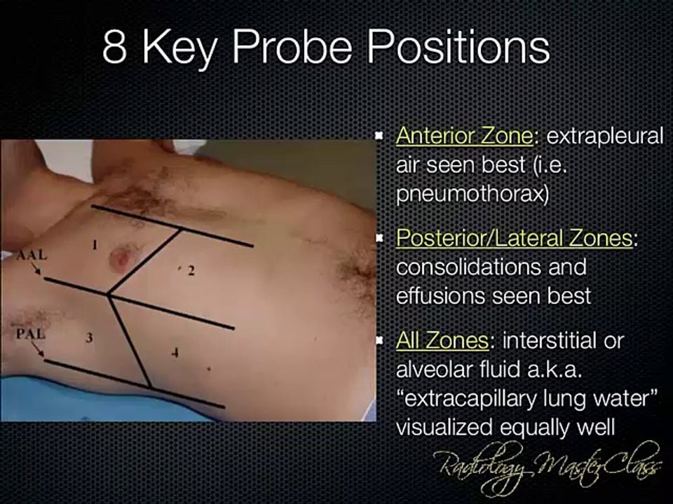 11- Lung Ultrasound