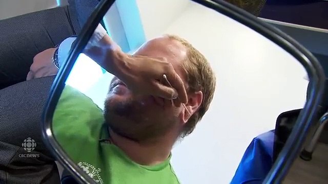 Guardate come avviene la RICOSTRUZIONE di orecchie deformate da piercing dilatatori... INCREDIBILE!