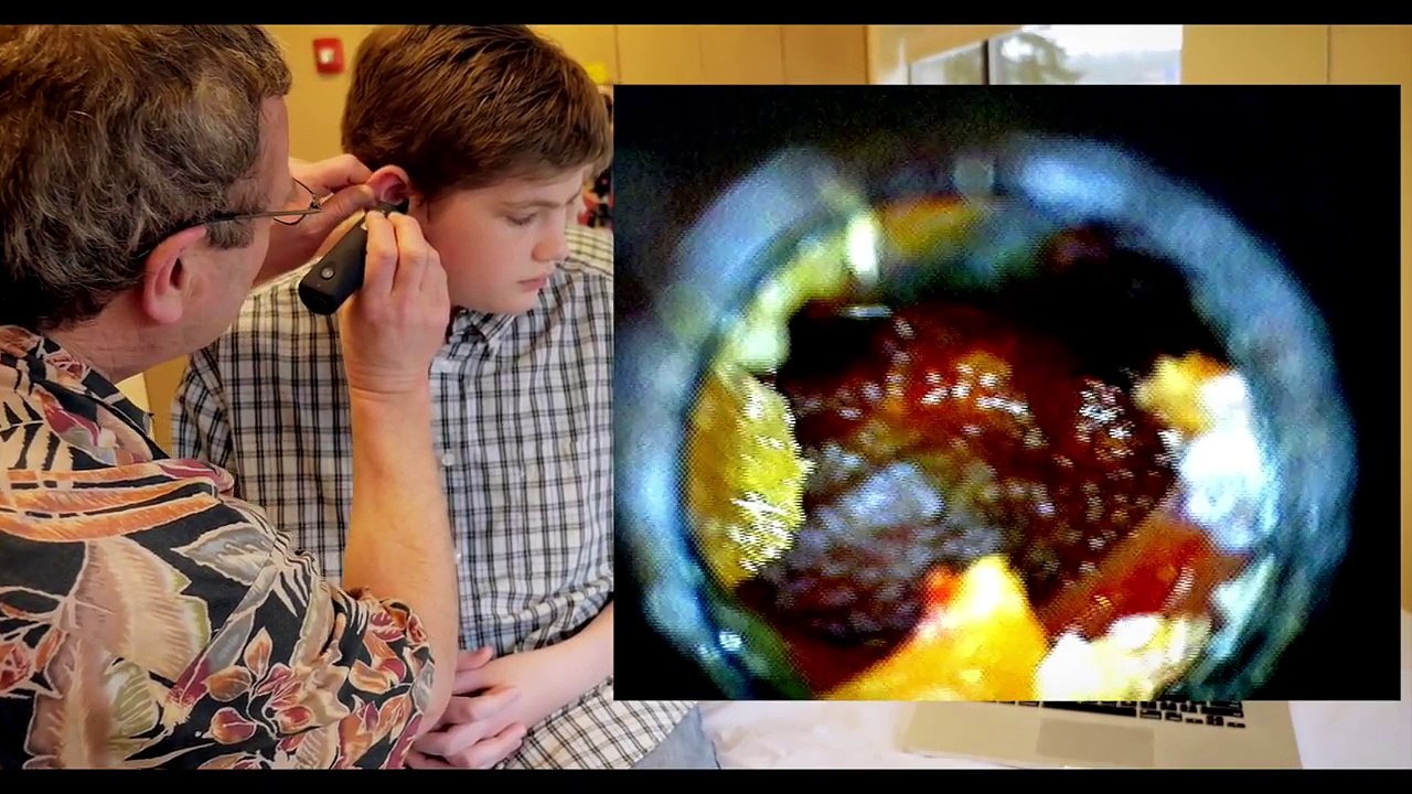 Le docteur lui insère cet instrument dans l'oreille, puis ce qui en sort... OH MON DIEU!