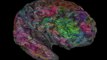 Amazing Brain Map Shows Where Words Are Stored in Your Noggin