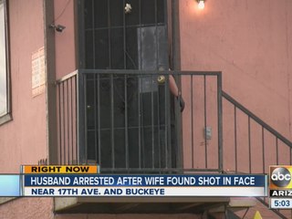 Husband arrested after wife found shot in face
