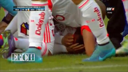 Sebastián Ubilla With One Of The Worst Injuries This Year!